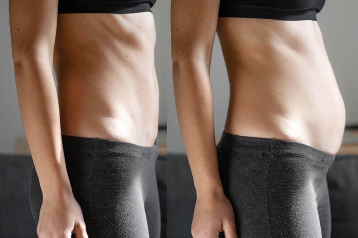 How long does diastasis recti take to improve Banbury?
