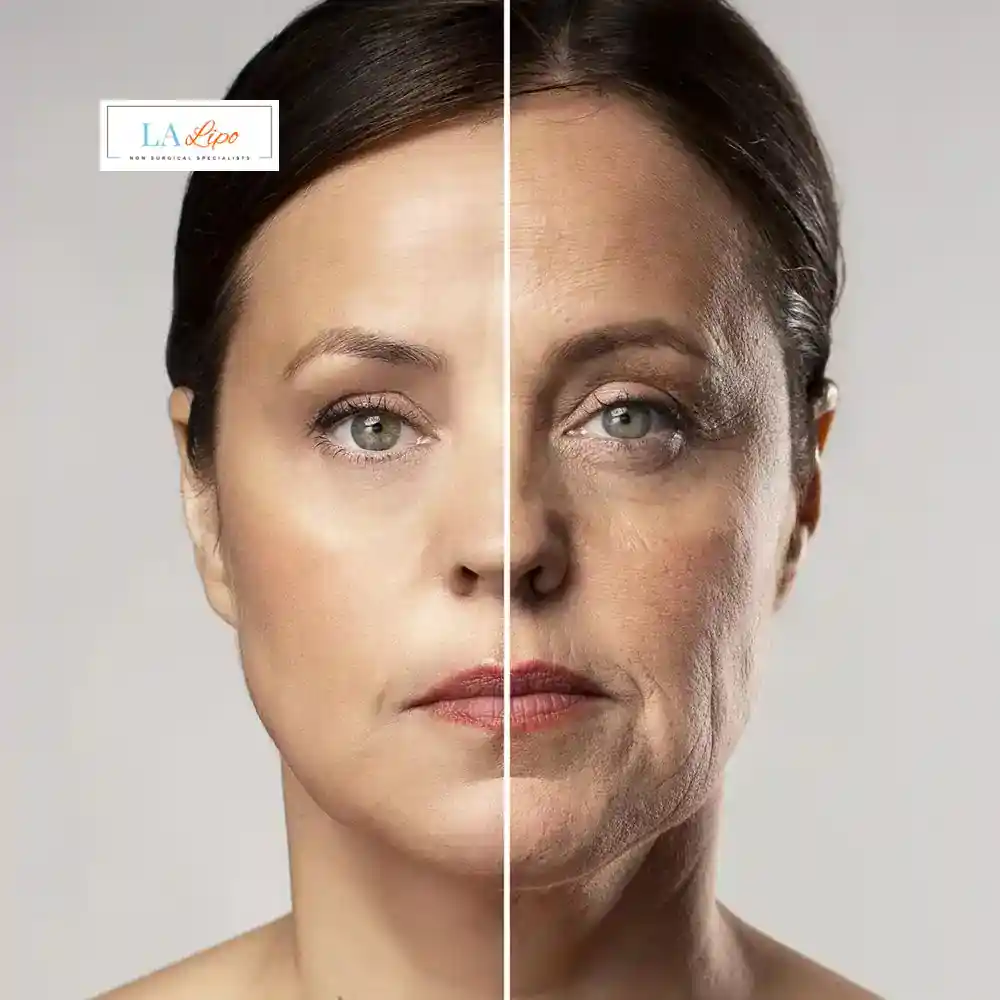 How Can You Tell If Non-Surgical Skin Tightening Is Right for You Banbury?